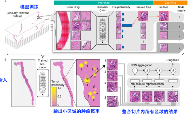 AI Pathology Analysis AI Pathology Analysis