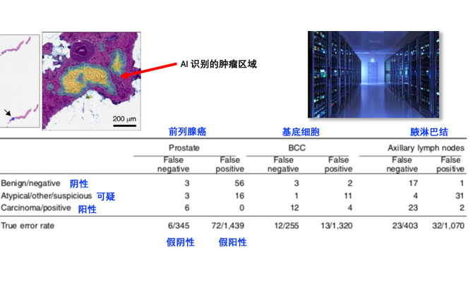 AI Pathology Analysis AI Pathology Analysis