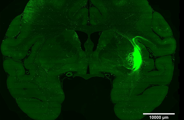 Imaging Figure