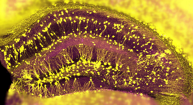 Whole-Brain Image Reconstruction Whole-Brain Image Reconstruction