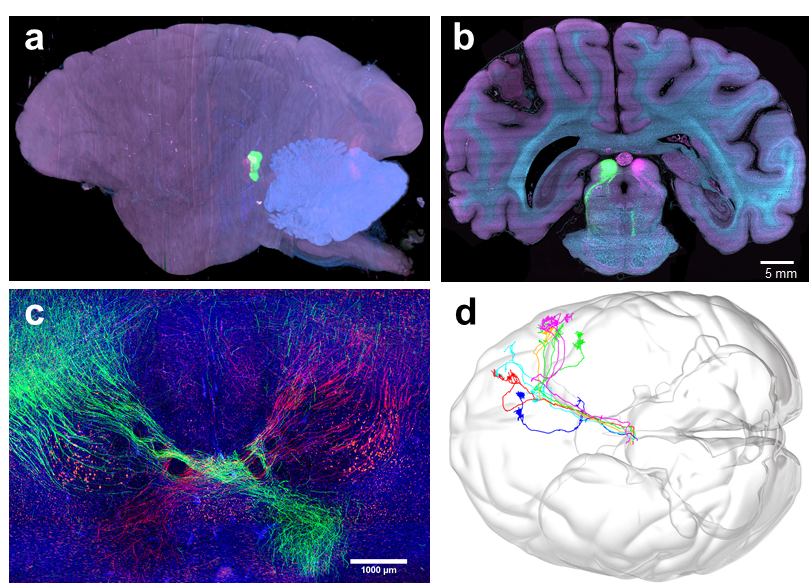 Chinese Scientists Develop World's Fastest Large-Scale 3D Microscopy Completes H
