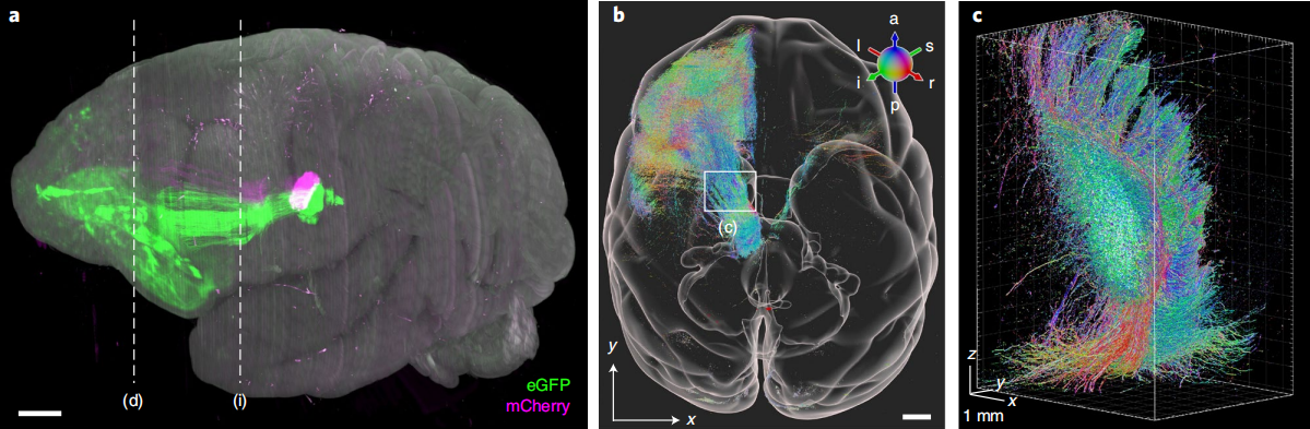 Completed the most precise macaque brain atlas mapping to date in 100 hours! Chinese scientists develop the world's fastest large-scale 3D microscopic imaging technology, accelerating progress toward deciphering the human brain | Interview