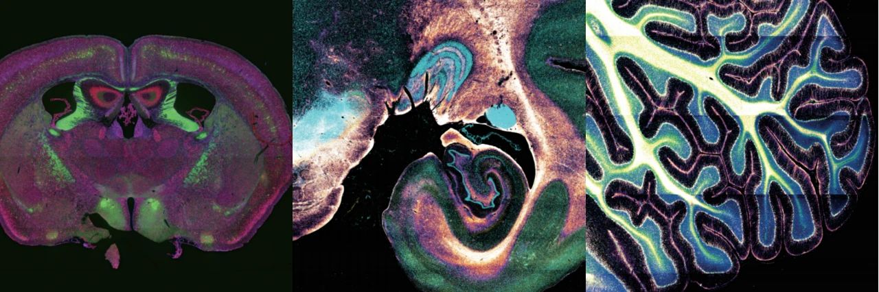 Completed the most precise macaque brain atlas mapping to date in 100 hours! Chinese scientists develop the world's fastest large-scale 3D microscopic imaging technology, accelerating progress toward deciphering the human brain | Interview